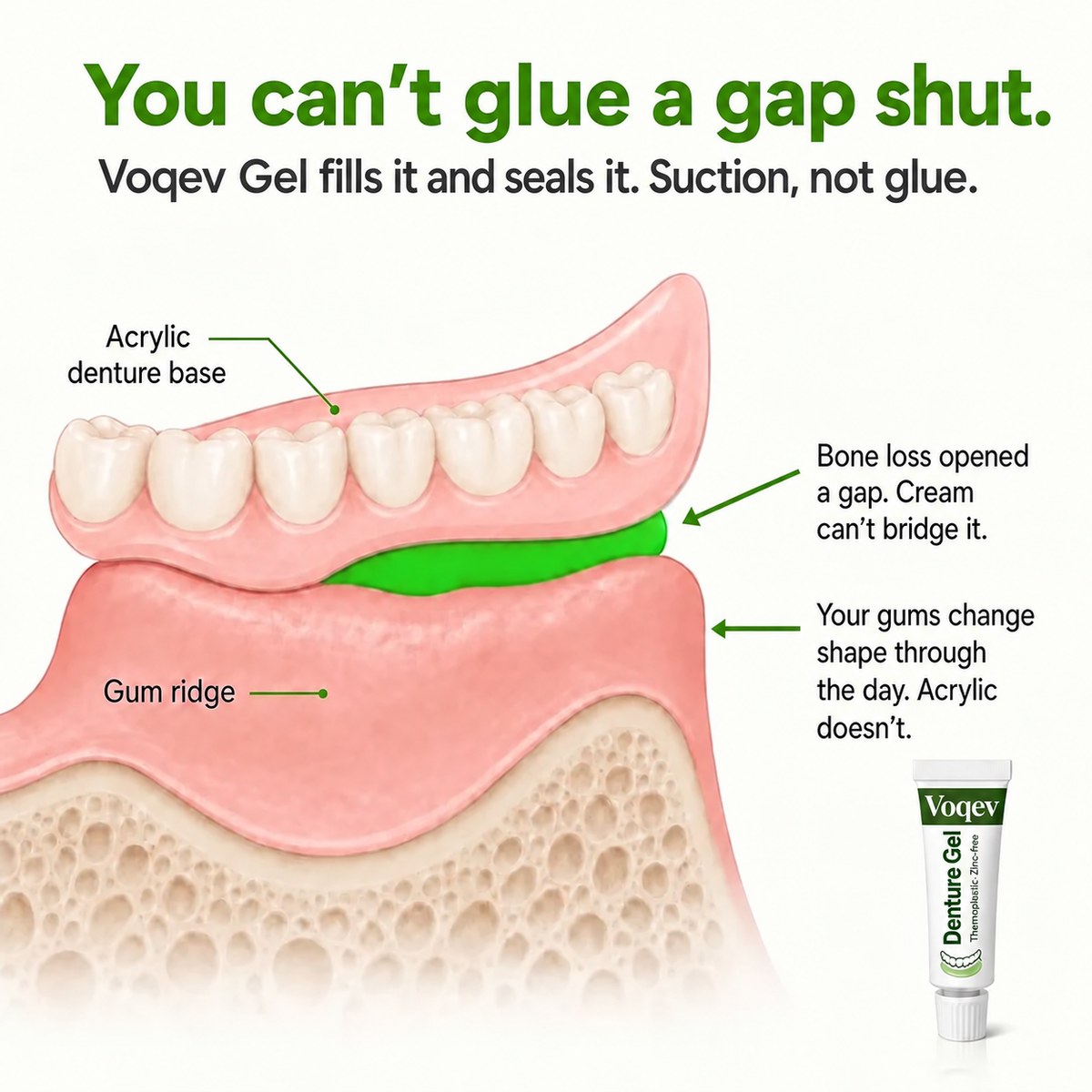 Voqev Gel | Stop Denture Slipping 100% - All-Day Secure Hold