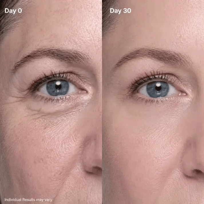 🔥Crème rénovatrice pour les yeux P7
