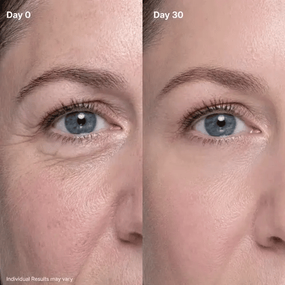 🔥Crème rénovatrice pour les yeux P7