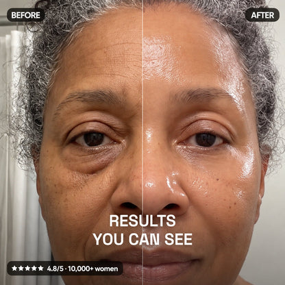 The PDRN Collagen Stick